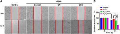 Multi-functional nanogel with cascade catalytic performance for treatment of diabetic oral mucosa ulcer